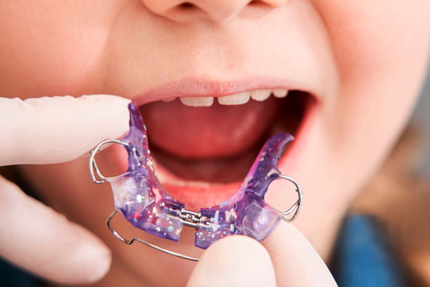aparato de ortopedia dental infantil