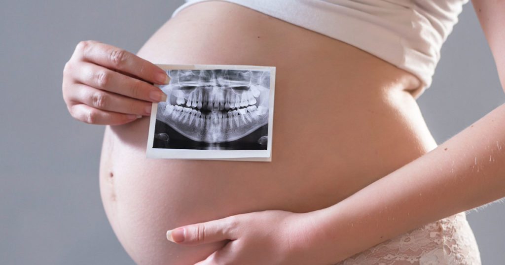 Embarazo radiografía