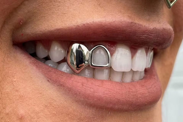 dientes de plata